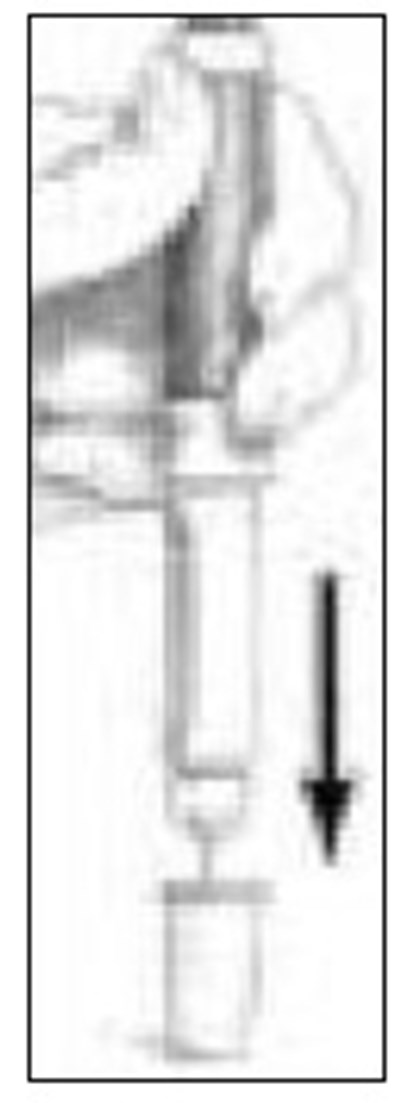 Figure 19 (Follistim Aq Cartridge 22)