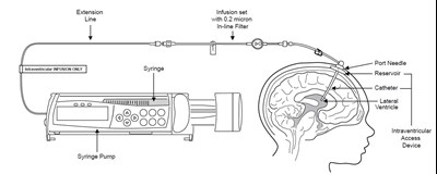 Figure 1 (Brineura 1)
