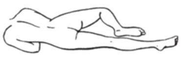 Fig-c (Fig C)