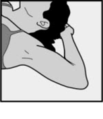 Figure 1 (Nexplanon 01)