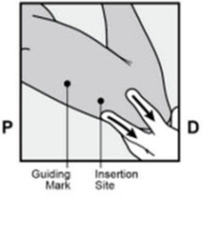 Figure 4 (Nexplanon 07)