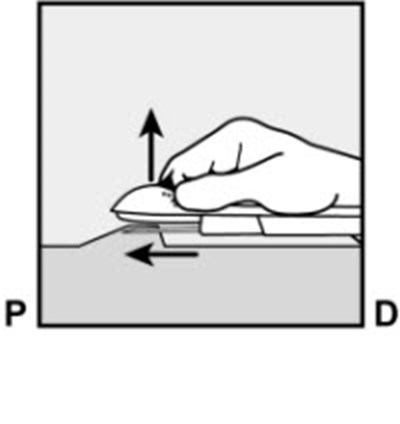 Figure 6 (Nexplanon 11)