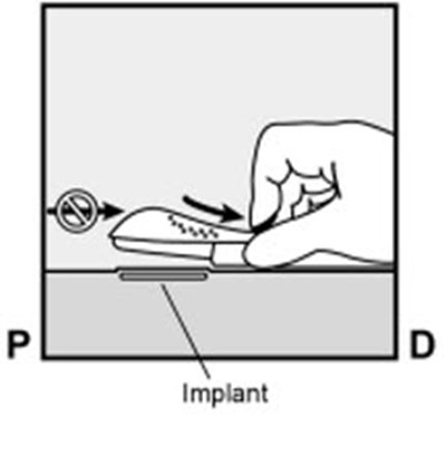 Figure 8b (Nexplanon 14)