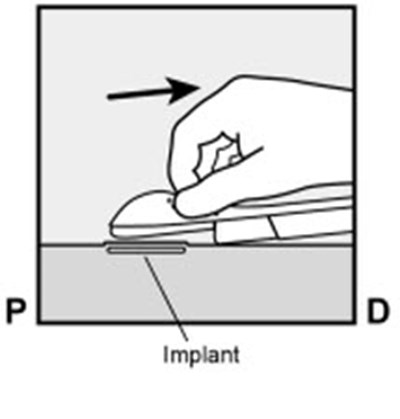 Figure 8c (Nexplanon 15)