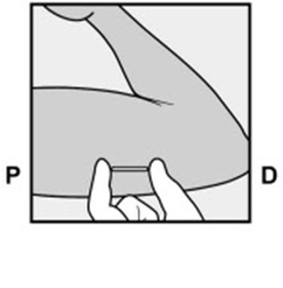 Figure 9 (Nexplanon 16)