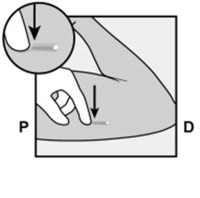 Figure 10 (Nexplanon 19)