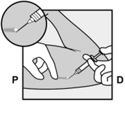 Figure 11 (Nexplanon 20)