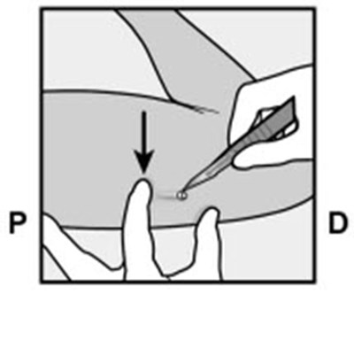 Figure 12 (Nexplanon 21)