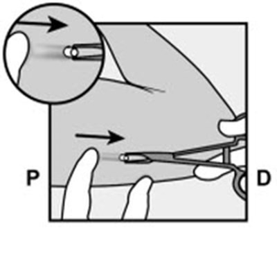 Figure 13 (Nexplanon 22)