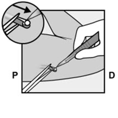 Figure 14 (Nexplanon 23)