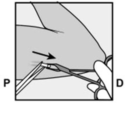 Figure 15 (Nexplanon 24)