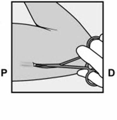 Figure 16 (Nexplanon 25)