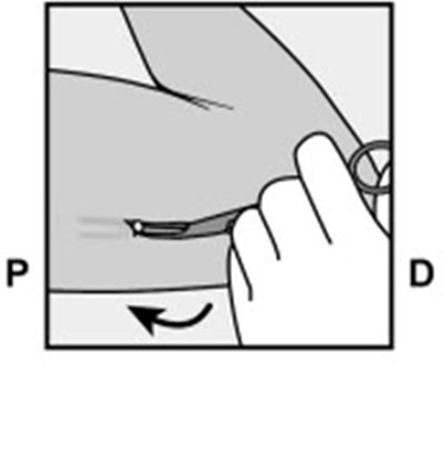 Figure 17 (Nexplanon 26)
