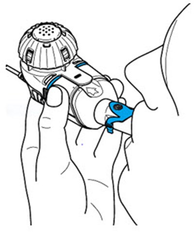 Figure (Arikayce 25)