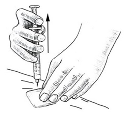 Figure K (Leuprolide Fig11)