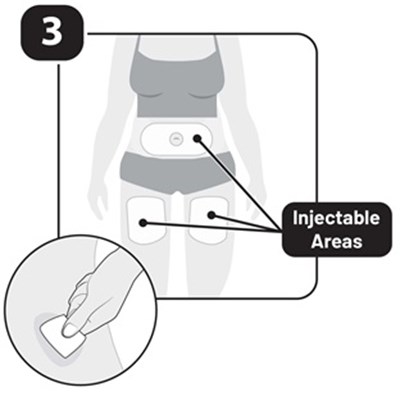 Figure 3 Prefilled Syringe Ifu (Fig Ifu 04 V2)