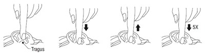 Spl-figure-e (Spl Figure E)