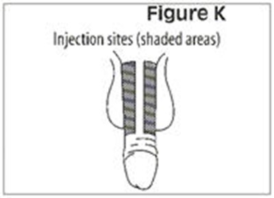 Figure K - caverject 14