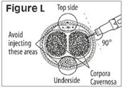 Figure L - caverject 15