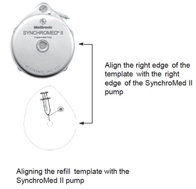 lioresal-09.jpg Figure 2 - lioresal 09