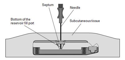 lioresal-10.jpg Figure 3 - lioresal 10