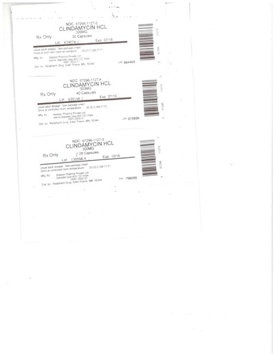 doc20170503154328_001.jpg CLINDAMYCIN 300MG - doc20170503154328 001