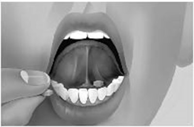 Bupr-naloxone-ifu-mouth-image (Image 03)
