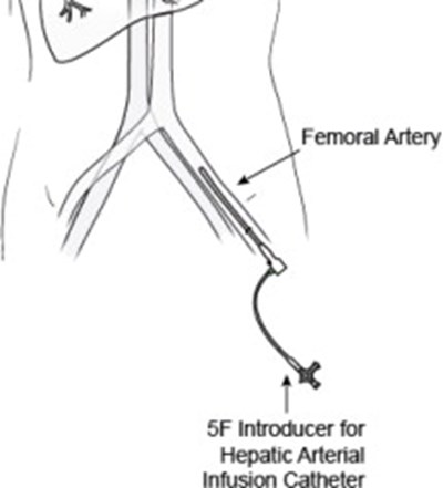 Figure (Hep11 0001 32)
