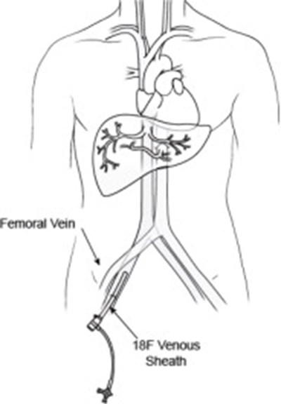 Figure (Hep11 0001 33)