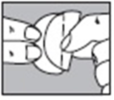 Application Figure Image (Nitroglycerin Patch 09)