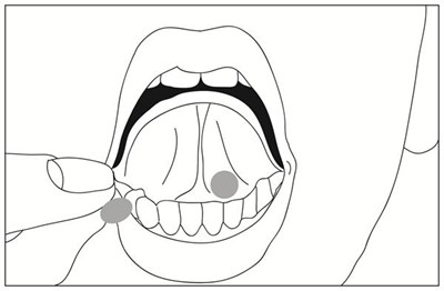 Mouth (Buprenorphine HCl And Naloxone HCl Dihydrate Subli 3)