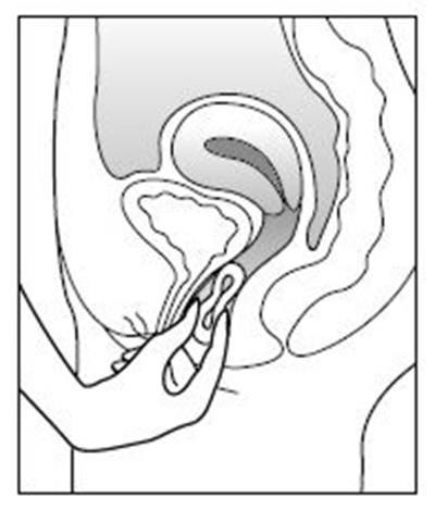 Figure (Estring 04)