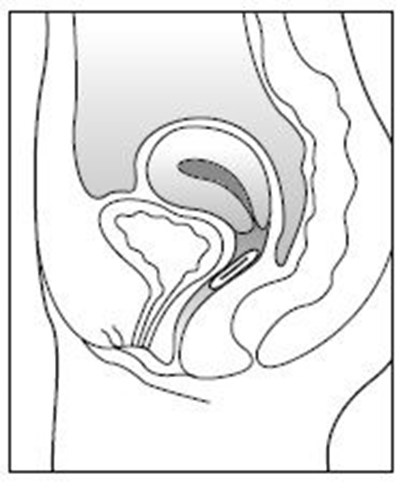 Figure (Estring 05)