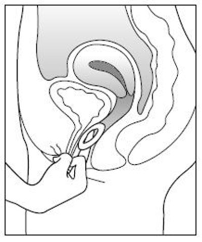 Figure (Estring 07)