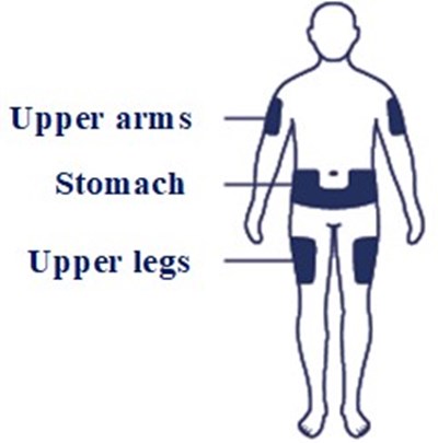 Injection_site (Injection Site)