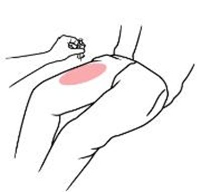 zimhi-08.jpg ZIMHITM is injected downwards, into the thigh, (as shown), through clothing if necessary. - zimhi 08