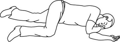 Turn The Patient On Their Side (recovery Position) After Giving Zimhi. (Zimhi 12)
