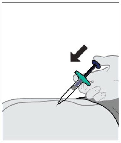 Figure J - yuflyma 37