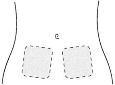 Figure F (Ica00 0002 09)