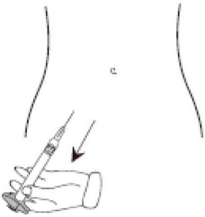 Figure N (Ica00 0002 17)