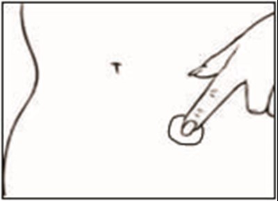 4g (Dotti Estradiol Transdermal System 16)