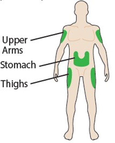 Figure4 (Langlara 4)