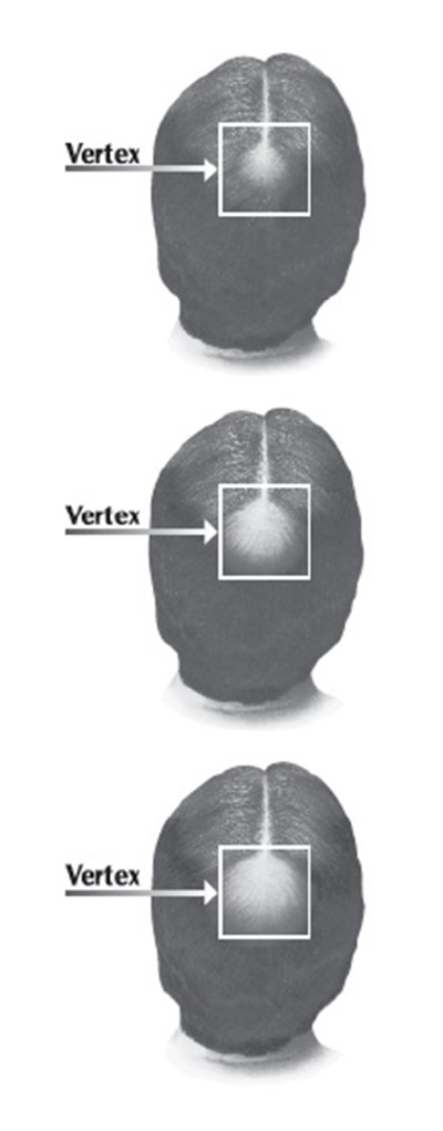 Fig (Minoxid Fig1)