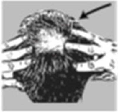 Fig (Minoxid Fig6)