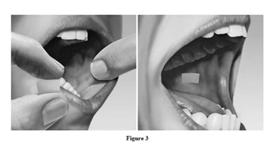 Figure-3 (Figure 3)