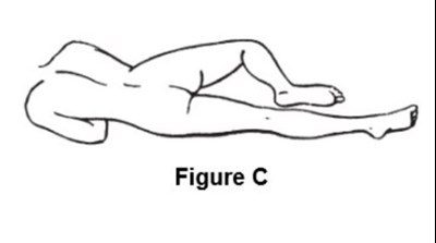 Fig-c (Fig C)