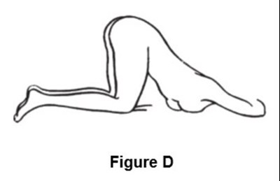 Fig-d (Fig D)