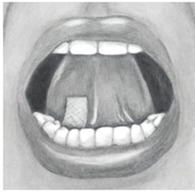 Instructions for Use Figure 2 - image 04