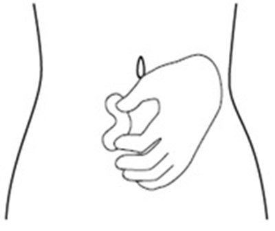 Figure G - icatibant fig8