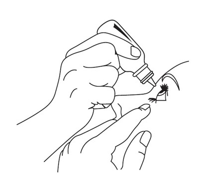 Timoptic-xe_ifu_fig C (Image 08)